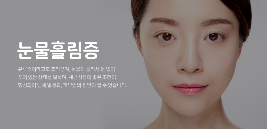 눈물흘림증
