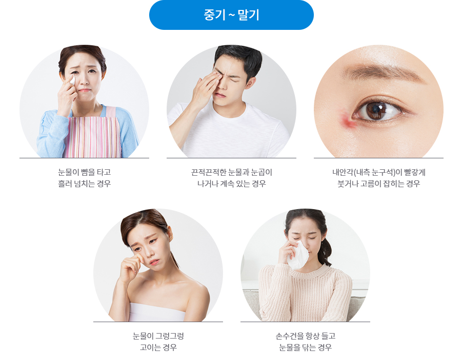 눈물흘림증 치료 대상