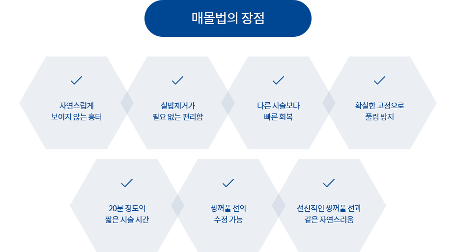 절개법 수술