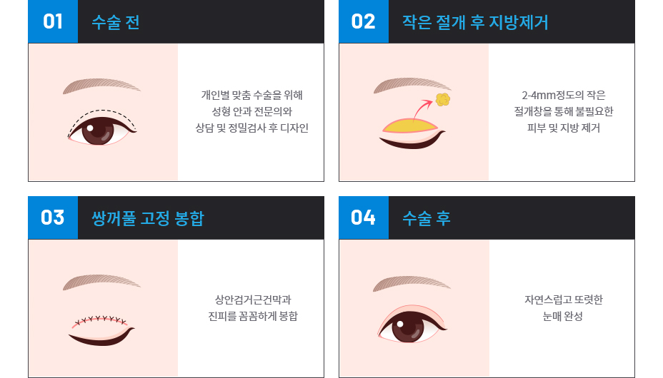 부분절개법