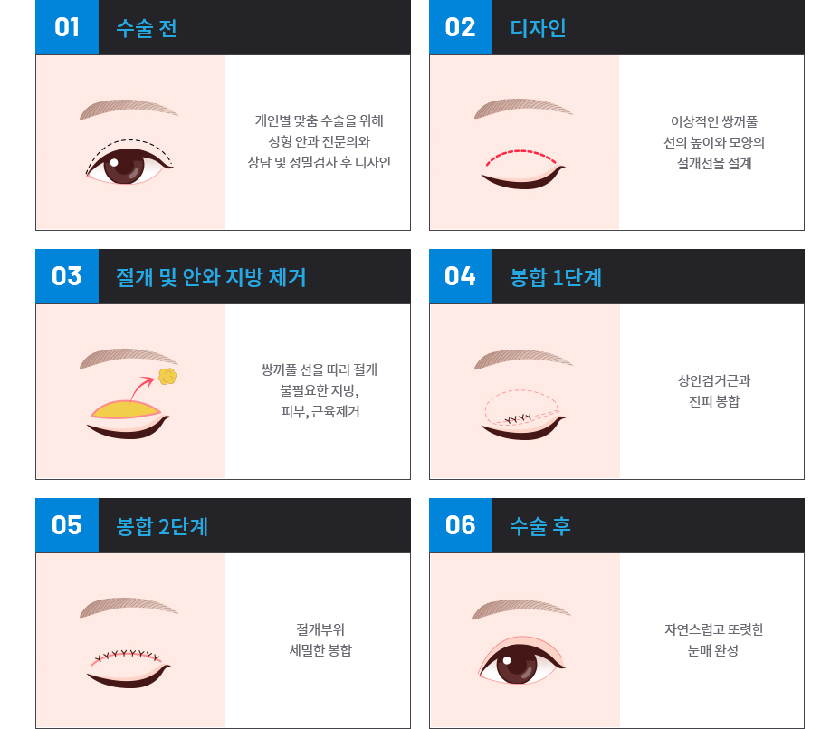 절개법