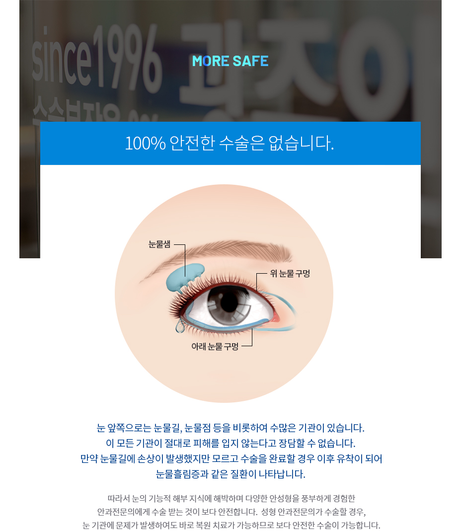 앞트임 성형 수술