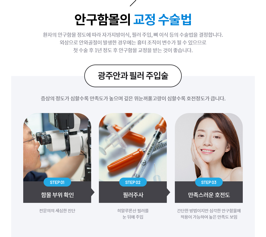 안구함몰의 교정 수술법
