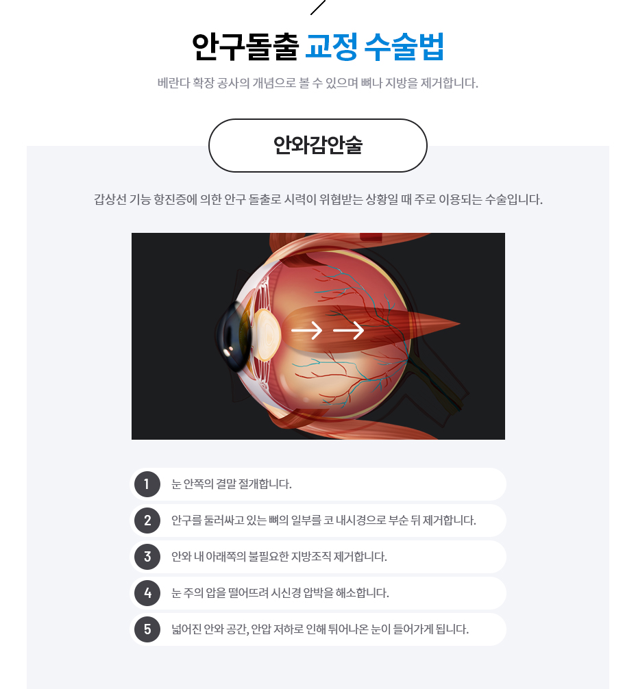 안구돌출 교정 수술법