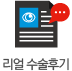 Real수술후기